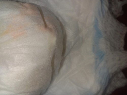 Red orange or orange sa diaper ng baby girl ko