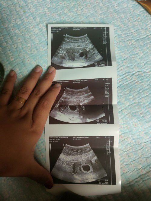 TOLONG JAWAB.  ILOVEYOU ALL MOMMIES 🤍🫰