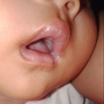 Bibir kering dan pucat