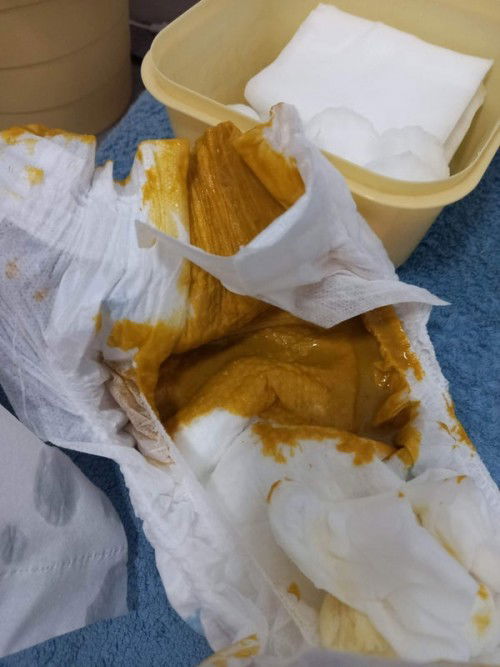 สอบถามแม่ๆหน่อยคะ