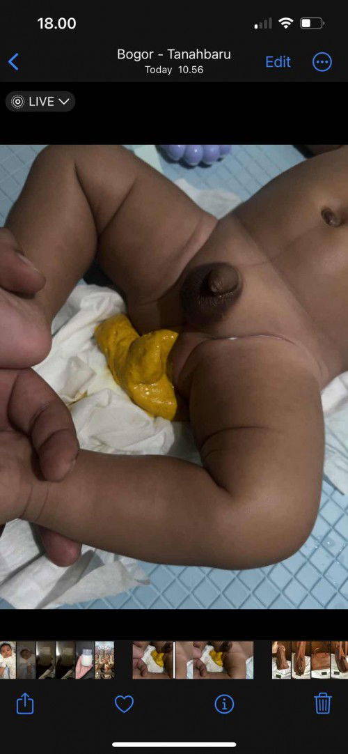 Apakah normal Bayi 2  bulan spt ini?