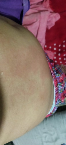 Itchy po red patch in my tummy