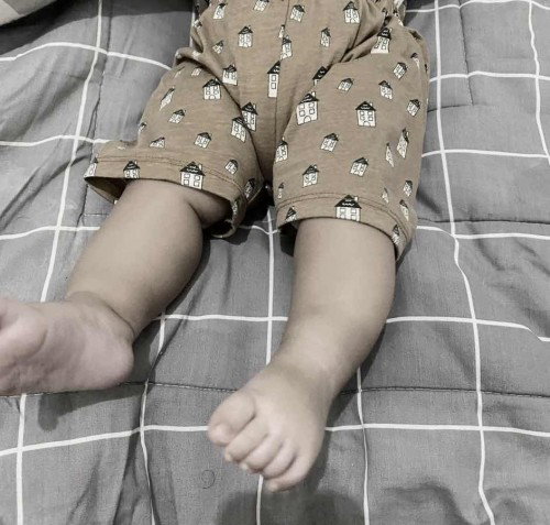 Bayi 6 bulan suka mengkakukan kaki
