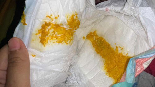 bun ini diare gak ya