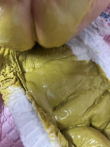 ลูก1เดือน20 วันถ่ายแบบในรูป