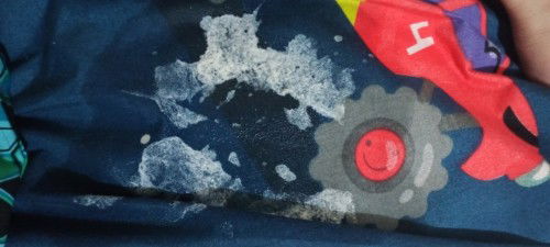 Bayi 5 bulan sering gumoh banyak