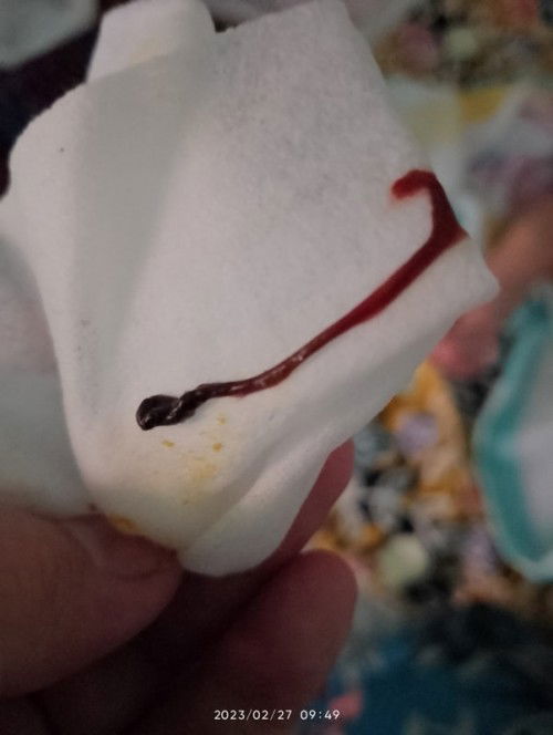 Darah kat kemaluan baby