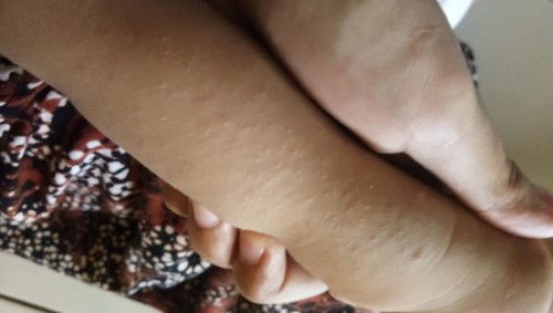 Tanya tentang kulit bayi