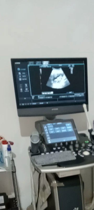 13w sudah jelas ya Bun