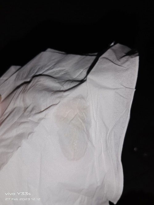 keputihan atau ketuban?