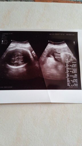 ขอสอบถามแม่ๆหน่อยค่ะ  นี้คือส่วนไหนค่ะ  แม่ดูม่เป็นค่ะ  ขอบคุณมากค่ะ☺️☺️☺️🙏