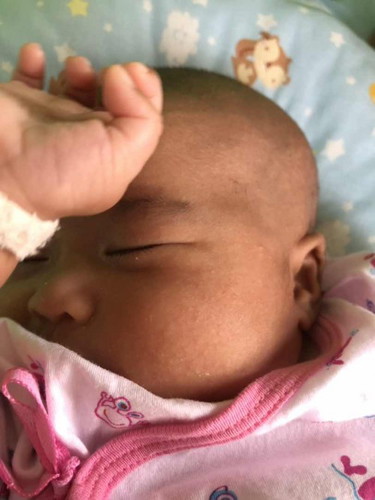 ผดผื่นลูกน้อย วัยแรกเกิด