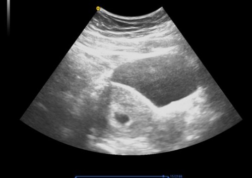 Hai,nak tanya. Ikut apps sy pregnant 7w3d, tapi sy pergi scan belum nampak janin,6w5d. Kenapa ye?