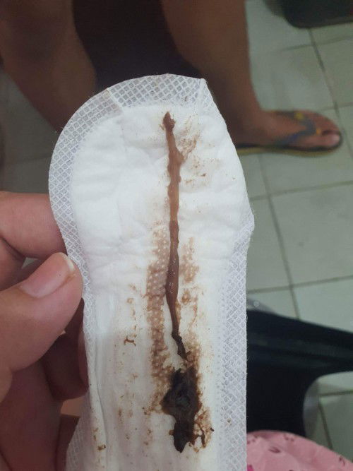 HELP MOMMIES!! Mucus Plug na nga ba ito?