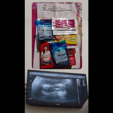 Alhamdulillah di kasih rezeki anak ke2 baru 2week doain ya bund semoga dapet anak cewek🥰