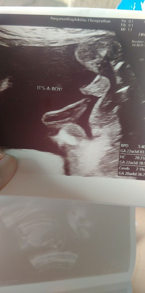 ผู้ชายแน่นอนไหมคะ