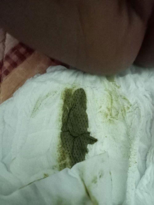 สงสัยอาการน้องถ่าย