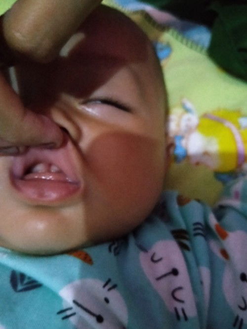 Bun apakah ini Lip tie