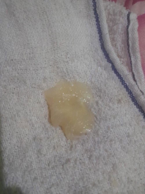 Keluar gumpalan lendir