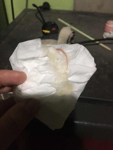 มีมูกแบบนี้ไหลออกมา