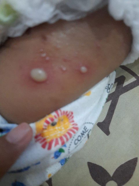 Hallo bun mau tanya ada yg pernah ngalami gak