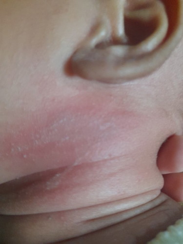 Leher bayi 2bulan