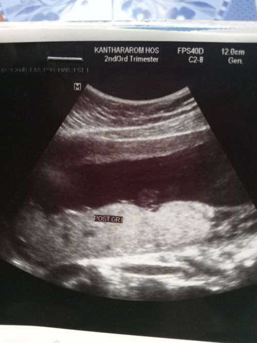 แม่ๆพอจะดูออกไหมค่ะว่าหนูเป็นชายหรือหญิงค่ะ