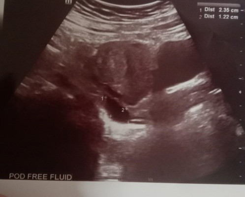 Fluid free pod