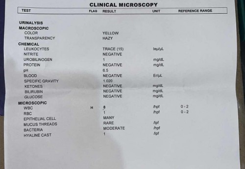 Pabalik balik na UTI