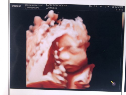 ขอดูรูปซาวด์แม่แม่ทีมมิถุนายน2566หน่อยค่ะ