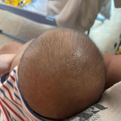 สอบถามแม่ๆค่ะ