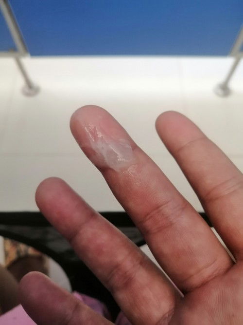 ท้อง​ 39+4​ สัปดาห์​