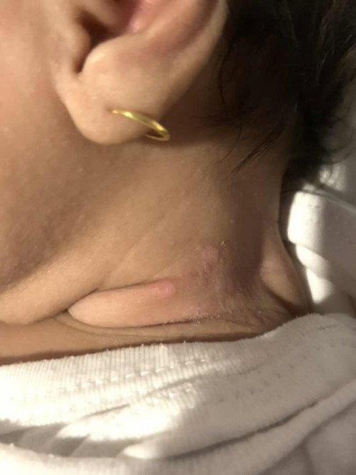 Kesehatan Kulit Bayi