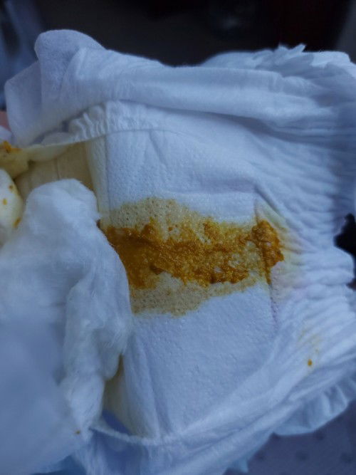 Poop ng 2 months mixed fed baby