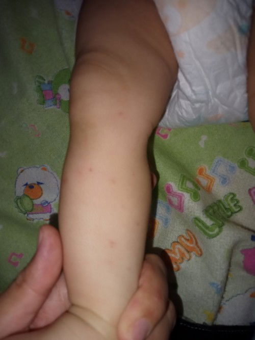 Ada yg pernah ngalamin gak bun ??
Anaku usia 3 bln lagi filek skrg di kaki ny ada bercak bintik