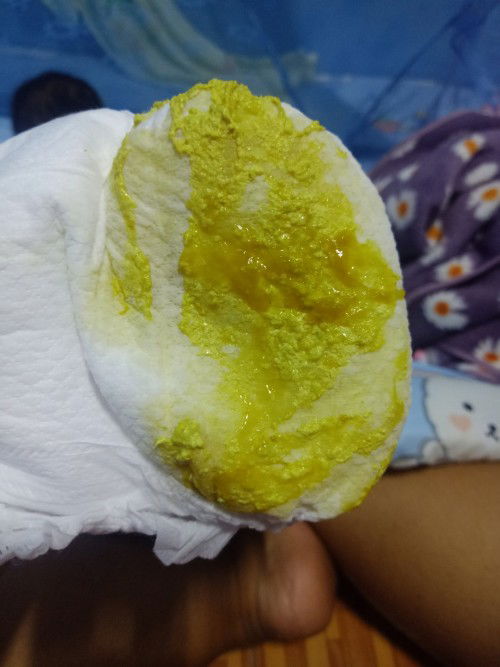 น้อง5เดือน2วัน