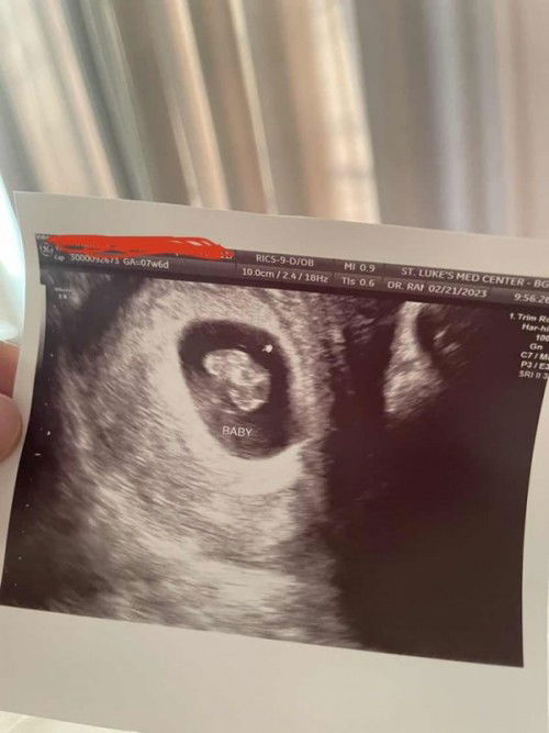 8weeks pregnant with Hemorrhage & Mayoma