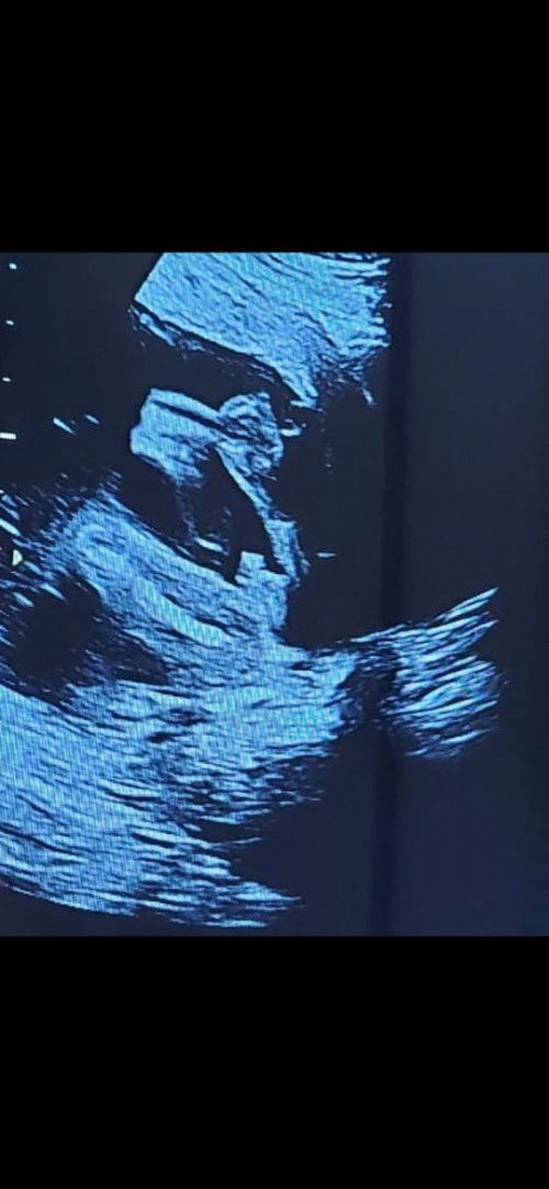 Bunda tolong bantu saran dong😇