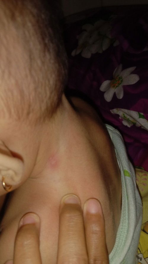 Saran obat buat bayi 8bulsn