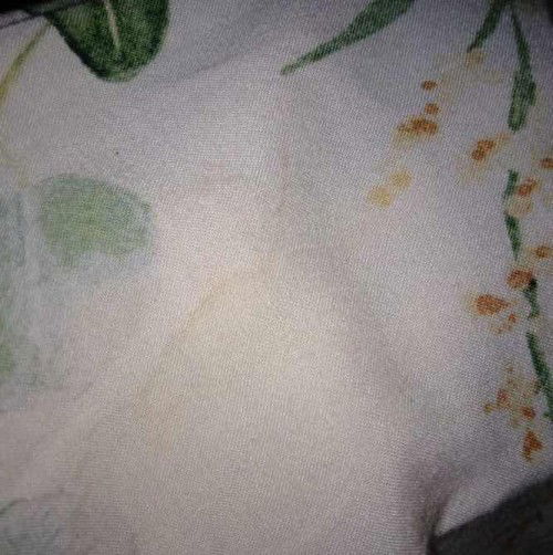 Apakah ketuban rembes??