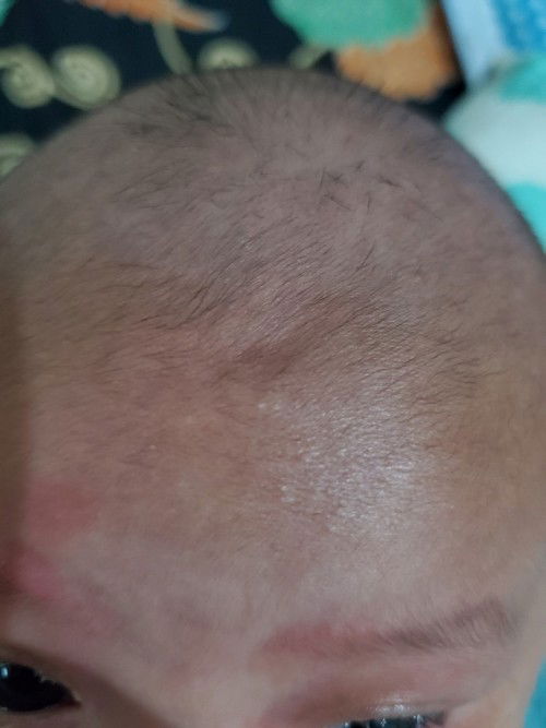 Ada cekungan di ubun-ubun bayi