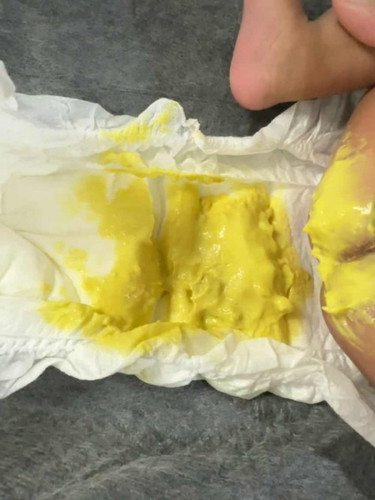 Is my 9 weeks old having diarrhoea?