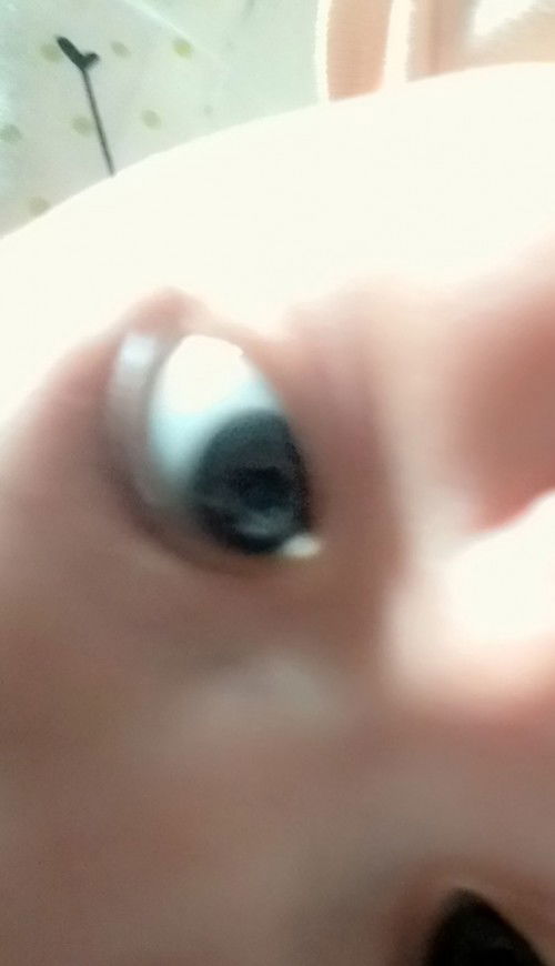 cahaya bocor dimata bayi