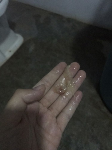 ทีมมีนาค่ะแม่ ตอนนี้38+5วีคแล้ว
เมื่อวานโดนตรวจปากมดลูก มีท้องปั้น+เหมือนปวดประจำเดือนทุกๆ10-20น. มีมูกเลือดไหลออกตอนตี4