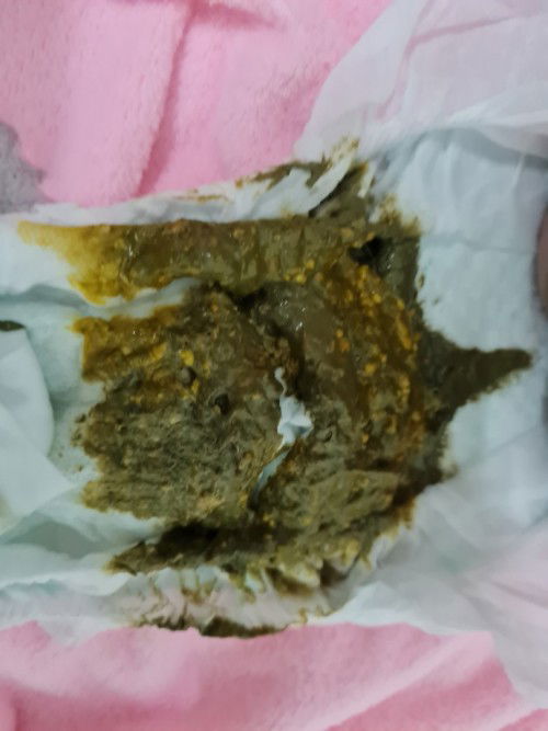 Phân v bt kh ạ
Bé đc 4th
3 4n mới đi 1l
Có bsung thêm sắt ạ