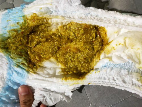 สอบถามแม่ๆหน่อยคะ