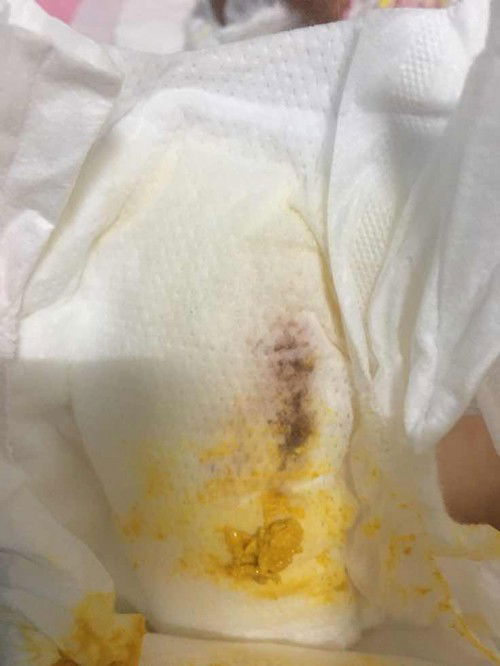 แพมเพิสทารก