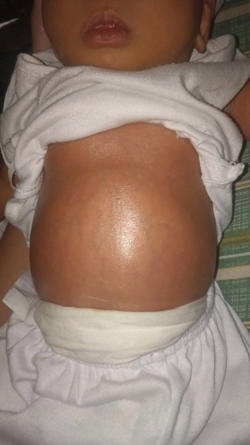 normal lang po ba laki ng tyan ng baby ko ?