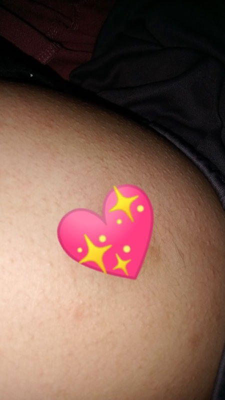 Usia kandungan 14-15Wk perut gatal dan ada bintik-bintik merah di seluruh perut dari sore kemarin.