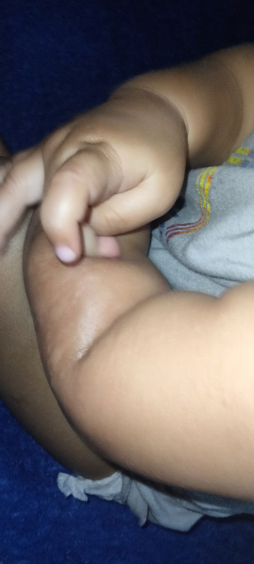 Anak saya kok tiba-tiba gatal-gatal begini ya. Saya jadi bingung, kira-kira obatnya apa ya bund?